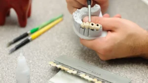 Dental Prosthesis in Albania